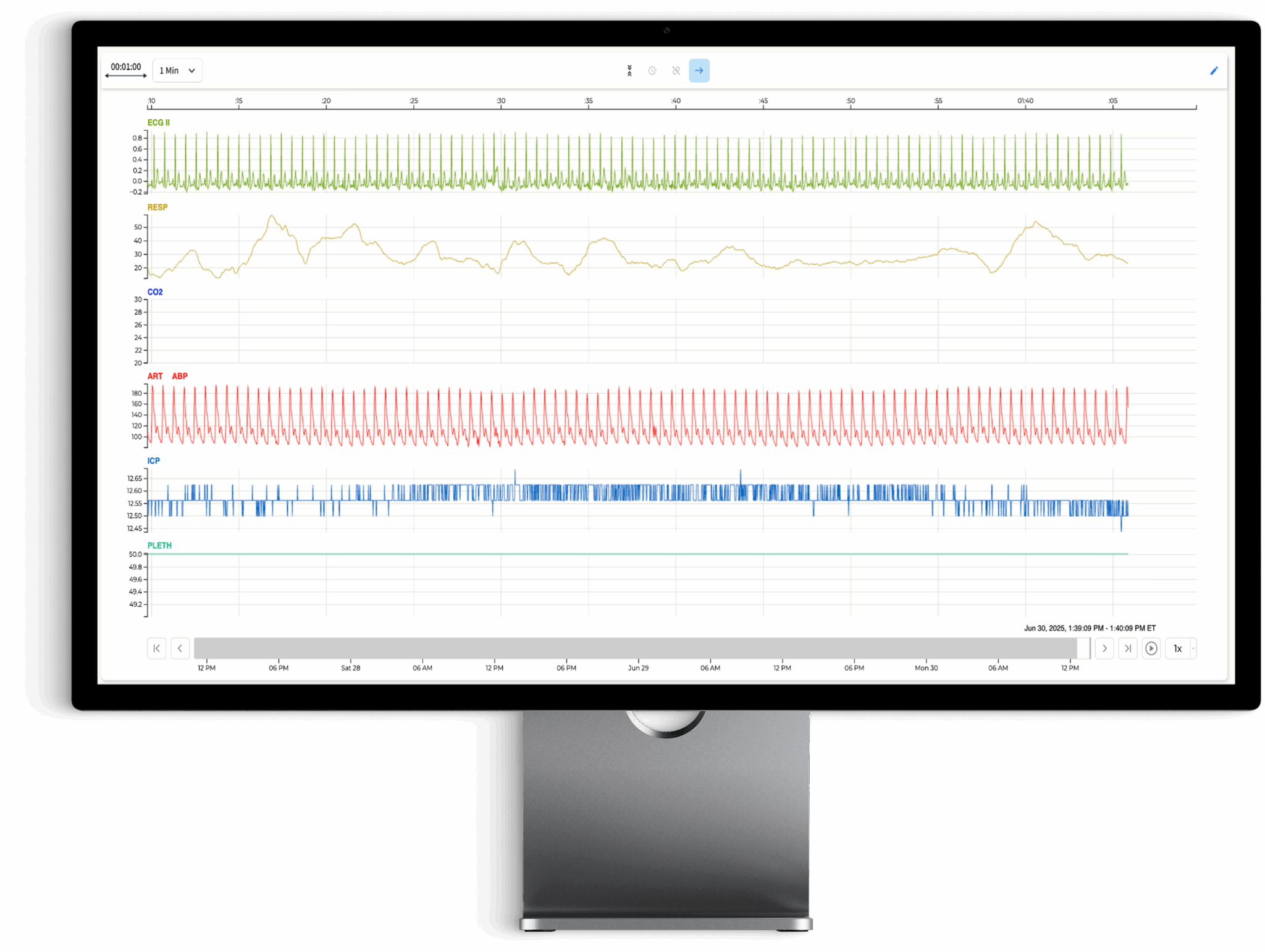 the moberg analytics Moberg Clinical Platform (MCP) Bedside Dashboard: Review Multimodal Data