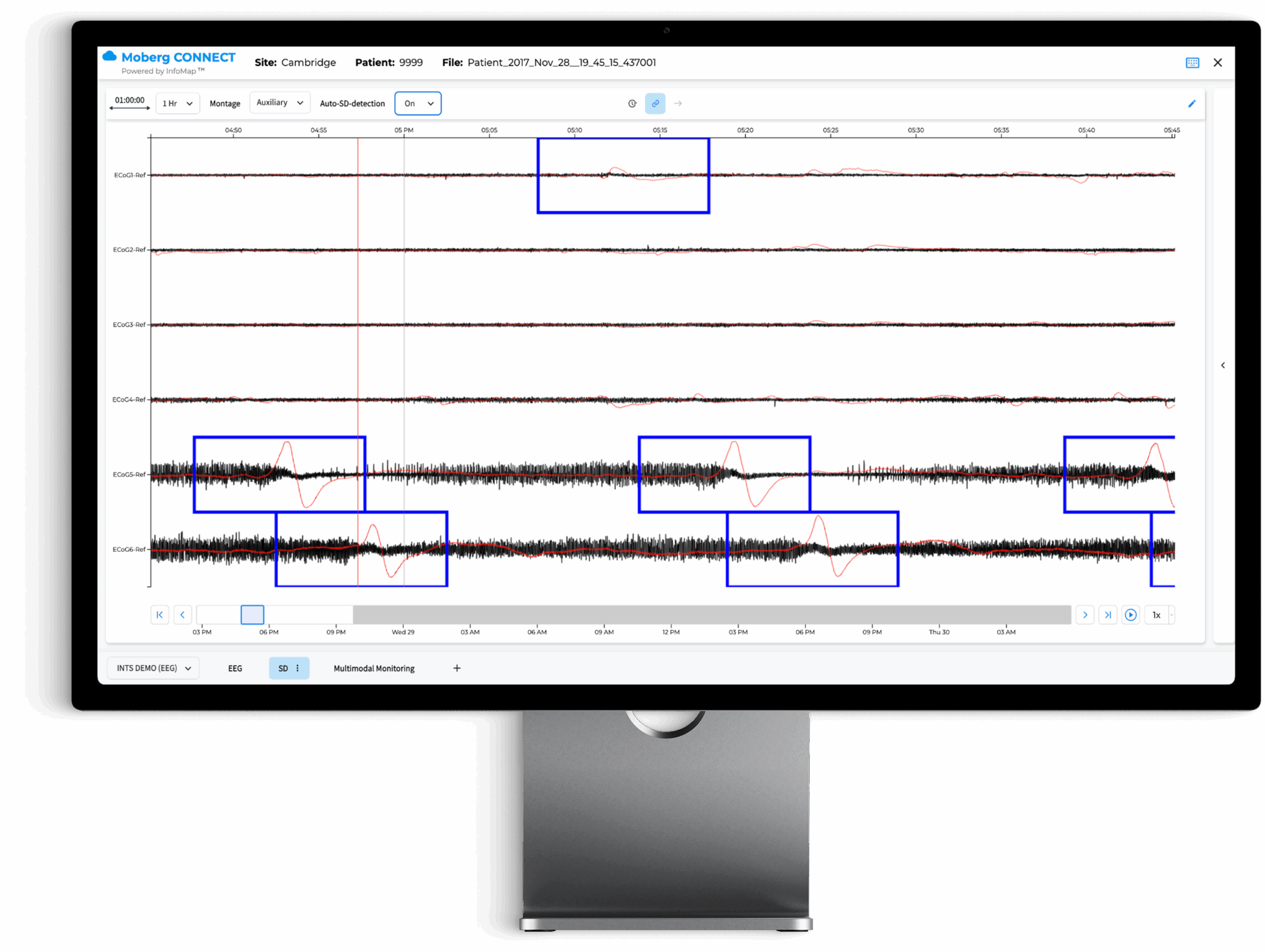 the moberg analytics Moberg Clinical Platform (MCP) Bedside Dashboard: Review Multimodal Data