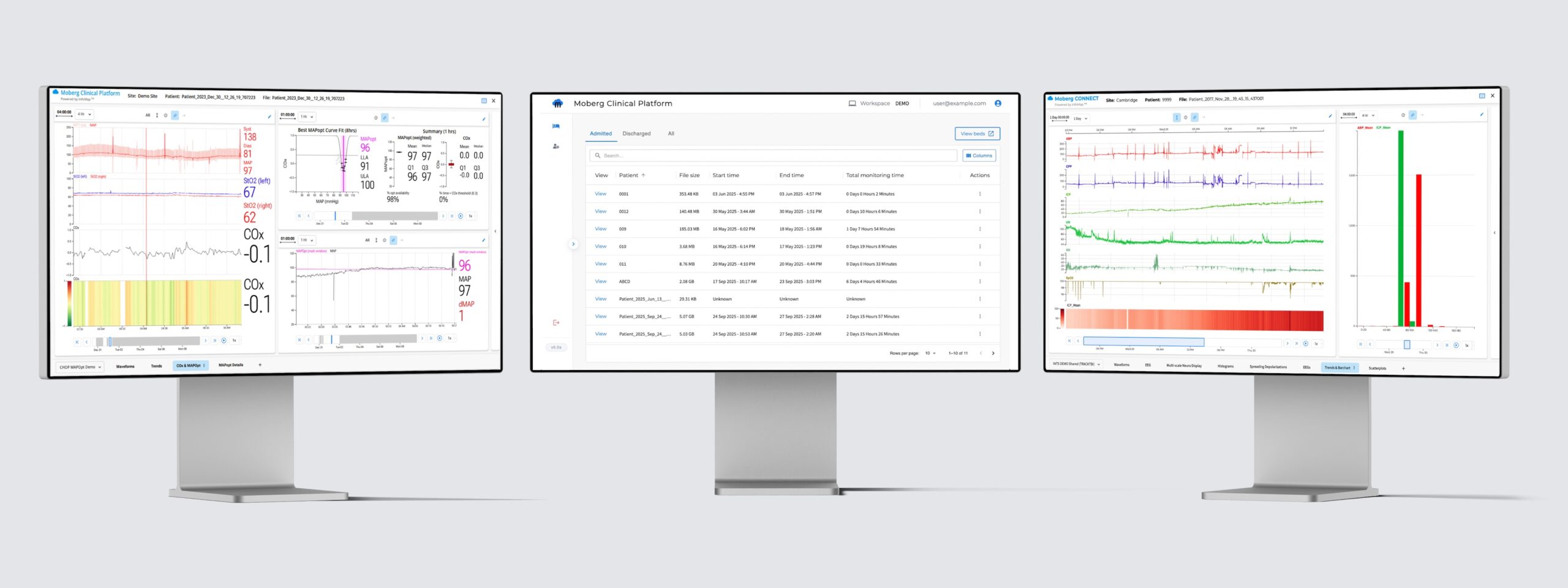 A mockup of the moberg clinical platform. advanced clinical intelligence for critical care